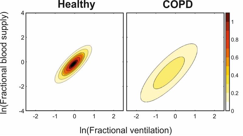 Graph showing distributions of both blood supply (vertical axis) and ventilation (horizontal axis) across the lung.