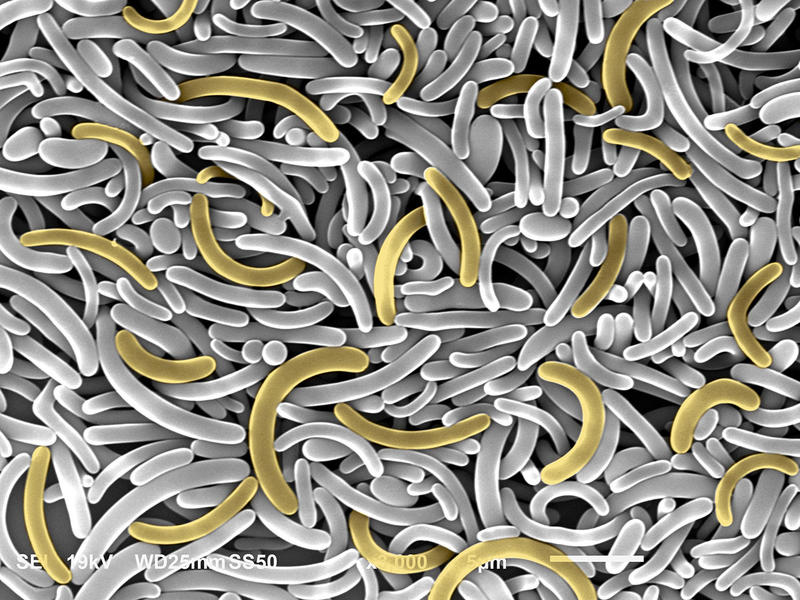 Scanning electron microscopy image of colloidal bananas scanning electron microscopy image of colloidal bananas