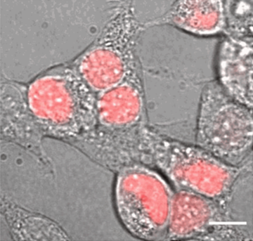 Microscopy image of cells, with some parts (the nuclei) coloured pink.